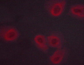 NOS3 / eNOS Antibody - Staining HeLa cells by IF/ICC. The samples were fixed with PFA and permeabilized in 0.1% saponin prior to blocking in 10% serum for 45 min at 37°C. The primary antibody was diluted 1/400 and incubated with the sample for 1 hour at 37°C. A Alexa Fluor 594 conjugated goat polyclonal to rabbit IgG (H+L), diluted 1/600 was used as secondary antibody.
