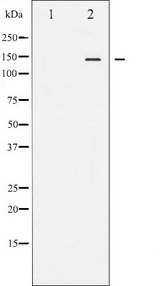NOS3 / eNOS Antibody - Western blot analysis of eNOS phosphorylation expression in Insulin treated HeLa whole cells lysates. The lane on the left is treated with the antigen-specific peptide.