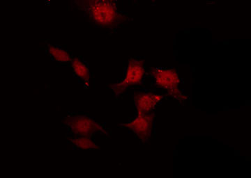 NOS3 / eNOS Antibody - Staining K562 cells by IF/ICC. The samples were fixed with PFA and permeabilized in 0.1% Triton X-100, then blocked in 10% serum for 45 min at 25°C. The primary antibody was diluted at 1:200 and incubated with the sample for 1 hour at 37°C. An Alexa Fluor 594 conjugated goat anti-rabbit IgG (H+L) Ab, diluted at 1/600, was used as the secondary antibody.