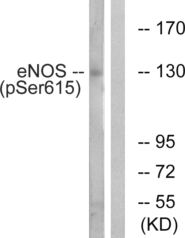 NOS3 / eNOS Antibody - Western blot analysis of lysates from K562 cells treated with EGF 40nM 30', using eNOS (Phospho-Ser615) Antibody. The lane on the right is blocked with the phospho peptide.