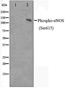 NOS3 / eNOS Antibody - Western blot of K562 cell lysate using Phospho-eNOS(Ser615) Antibody.