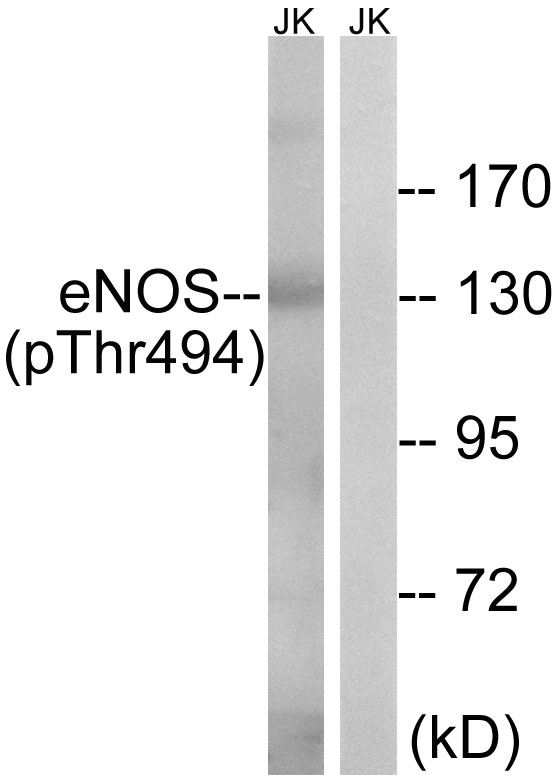 NOS3 / eNOS Antibody - Western blot analysis of lysates from Jurkat cells, using eNOS (Phospho-Thr494) Antibody. The lane on the right is blocked with the phospho peptide.