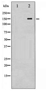 NOS3 / eNOS Antibody - Western blot of eNOS phosphorylation expression in HepG2 whole cell lysates,The lane on the left is treated with the antigen-specific peptide.