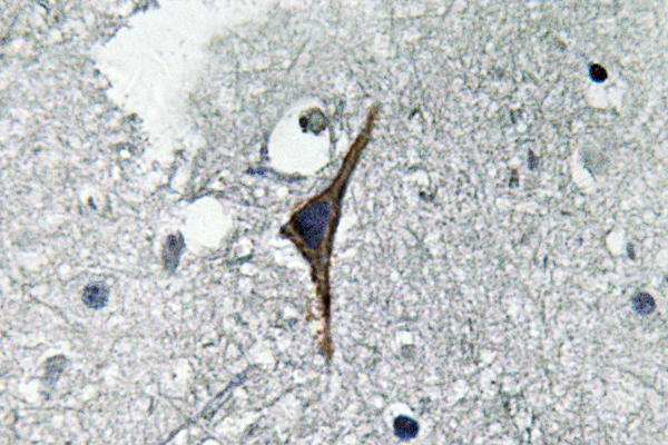 NOS3 / eNOS Antibody - IHC of NOS3 (S1170) pAb in paraffin-embedded human brain tissue.