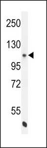 NOS3 / eNOS Antibody - eNos Antibody (S1177) western blot of K562 cell line lysates (35 ug/lane). The eNos antibody detected the eNos protein (arrow).