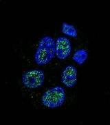NOS3 / eNOS Antibody - Confocal immunofluorescence of eNos Antibody (S1177) with HepG2 cell followed by Alexa Fluor 488-conjugated goat anti-rabbit lgG (green). DAPI was used to stain the cell nuclear (blue).