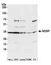 NOSIP Antibody - Detection of human and mouse NOSIP by western blot. Samples: Whole cell lysate (50 µg) from HeLa, HEK293T, Jurkat, mouse TCMK-1, and mouse NIH 3T3 cells prepared using NETN lysis buffer. Antibody: Affinity purified rabbit anti-NOSIP antibody used for WB at 0.1 µg/ml. Detection: Chemiluminescence with an exposure time of 30 seconds.