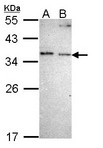 NOSIP Antibody - Sample (30 ug of whole cell lysate). A: A431 , B: H1299. 12% SDS PAGE. NOSIP antibody diluted at 1:1000.
