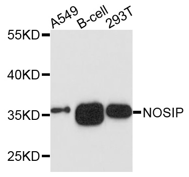 NOSIP Antibody - Western blot analysis of extracts of various cells.