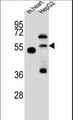 NOSTRIN Antibody - NOSTRIN Antibody western blot of mouse heart tissue and HepG2 cell line lysates (35 ug/lane). The NOSTRIN antibody detected the NOSTRIN protein (arrow).
