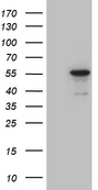 NOSTRIN Antibody - HEK293T cells were transfected with the pCMV6-ENTRY control. (Left lane) or pCMV6-ENTRY NOSTRIN. (Right lane) cDNA for 48 hrs and lysed. Equivalent amounts of cell lysates. (5 ug per lane) were separated by SDS-PAGE and immunoblotted with anti-NOSTRIN. (1:2000)
