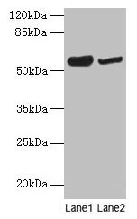 NOSTRIN Antibody - Western blot All lanes: NOSTRIN antibody at 6µg/ml Lane 1: Mouse heart tissue Lane 2: Mouse brain tissue Secondary Goat polyclonal to rabbit IgG at 1/10000 dilution Predicted band size: 58, 55, 49, 65 kDa Observed band size: 58 kDa