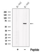 NOSTRIN Antibody - Western blot analysis of extracts of K562 cells using NOSTRIN antibody. The lane on the left was treated with blocking peptide.
