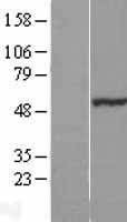 NOSTRIN Protein - Western validation with an anti-DDK antibody * L: Control HEK293 lysate R: Over-expression lysate