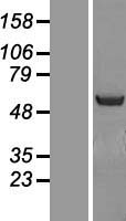 NOSTRIN Protein - Western validation with an anti-DDK antibody * L: Control HEK293 lysate R: Over-expression lysate