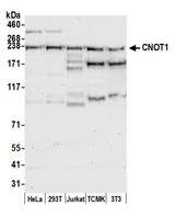 NOT1 / CNOT1 Antibody - Detection of human and mouse CNOT1 by western blot. Samples: Whole cell lysate (50 µg) from HeLa, HEK293T, Jurkat, mouse TCMK-1, and mouse NIH 3T3 cells prepared using NETN lysis buffer. Antibody: Affinity purified rabbit anti-CNOT1 antibody used for WB at 1:1000. Detection: Chemiluminescence with an exposure time of 30 seconds.