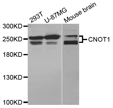 NOT1 / CNOT1 Antibody - Western blot analysis of extracts of various cell lines.