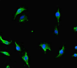 NOT1 / CNOT1 Antibody - Immunofluorescent analysis of U251 cells diluted at 1:100 and Alexa Fluor 488-congugated AffiniPure Goat Anti-Rabbit IgG(H+L)
