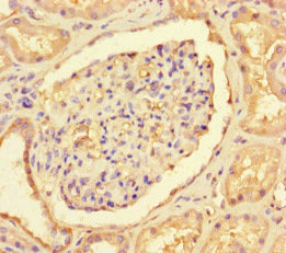 NOT1 / CNOT1 Antibody - Immunohistochemistry of paraffin-embedded human kidney tissue at dilution of 1:100