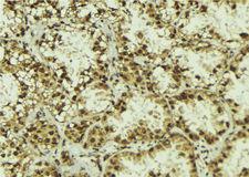 NOT1 / CNOT1 Antibody - 1:100 staining human lung tissue by IHC-P. The sample was formaldehyde fixed and a heat mediated antigen retrieval step in citrate buffer was performed. The sample was then blocked and incubated with the antibody for 1.5 hours at 22°C. An HRP conjugated goat anti-rabbit antibody was used as the secondary.
