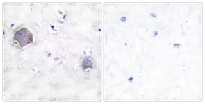 NOTCH1 Antibody - IHC of paraffin-embedded human brain tissue, using Notch 1 (Cleaved-Val1754) Antibody. The picture on the right is treated with the synthesized peptide.
