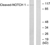 NOTCH1 Antibody - Western blot of extracts from NIH-3T3 cells, treated with Etoposide 25 uM 60', using Notch 1 (Cleaved-Val1754) Antibody. The lane on the right is treated with the synthesized peptide.