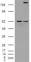 NOTCH1 Antibody - HEK293T cells were transfected with the pCMV6-ENTRY control (Left lane) or pCMV6-ENTRY Notch1 (Right lane) cDNA for 48 hrs and lysed. Equivalent amounts of cell lysates (5 ug per lane) were separated by SDS-PAGE and immunoblotted with anti-Notch1.