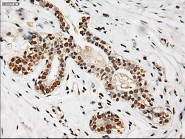 NOTCH1 Antibody - IHC of paraffin-embedded breast using anti-Notch1 mouse monoclonal antibody.