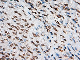 NOTCH1 Antibody - IHC of paraffin-embedded endometrium using anti-Notch1 mouse monoclonal antibody.