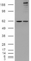 NOTCH1 Antibody - HEK293T cells were transfected with the pCMV6-ENTRY control (Left lane) or pCMV6-ENTRY NOTCH1 (Right lane) cDNA for 48 hrs and lysed. Equivalent amounts of cell lysates (5 ug per lane) were separated by SDS-PAGE and immunoblotted with anti-NOTCH1.