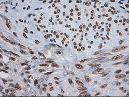 NOTCH1 Antibody - IHC of paraffin-embedded endometrium tissue using anti-NOTCH1 mouse monoclonal antibody. (Dilution 1:50).