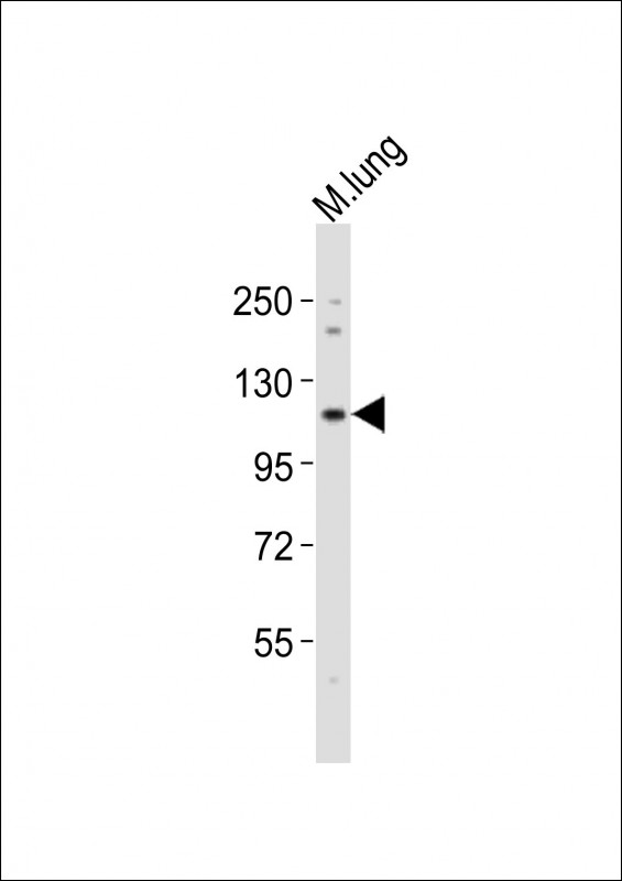 NOTCH1 Antibody - Anti-Notch1 Antibody at 1:2000 dilution + mouse lung lysates Lysates/proteins at 20 ug per lane. Secondary Goat Anti-Rabbit IgG, (H+L), Peroxidase conjugated at 1/10000 dilution Predicted band size : 271 kDa Blocking/Dilution buffer: 5% NFDM/TBST.