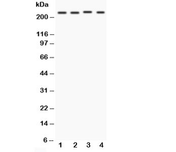 NOTCH1 Antibody - Western blot testing of Notch1 antibody and Lane 1: MCF-7; 2: HeLa; 3: Jurkat; 4: COLO320. Predicted molecular weight: ~ 270 kDa (full length), ~ 120 kDa (transmembrane fragment).
