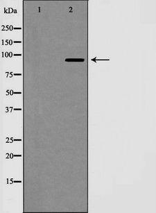 NOTCH1 Antibody - Western blot analysis of Notch 1 (Cleaved-Val1744) expression in NIH 3T3 cells extract treated with etoposide. The lane on the left is treated with the antigen-specific peptide.