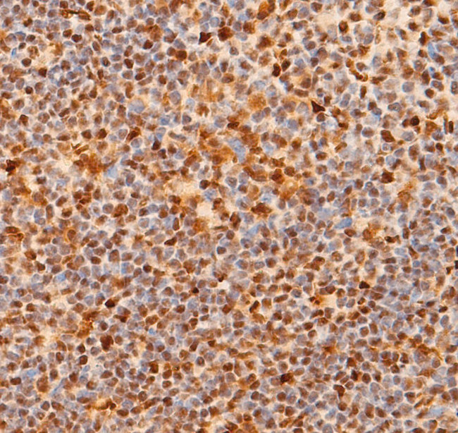 NOTCH1 Antibody - 1:200 staining mouse spleen tissue by IHC-P. The tissue was formaldehyde fixed and a heat mediated antigen retrieval step in citrate buffer was performed. The tissue was then blocked and incubated with the antibody for 1.5 hours at 22°C. An HRP conjugated goat anti-rabbit antibody was used as the secondary.