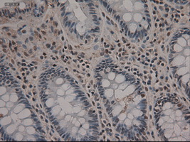 NOTCH1 Antibody - IHC of paraffin-embedded colon using anti-Notch1 mouse monoclonal antibody.