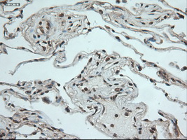 NOTCH1 Antibody - IHC of paraffin-embedded lung using anti-Notch1 mouse monoclonal antibody.