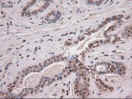 NOTCH1 Antibody - IHC of paraffin-embedded breast tissue using anti-NOTCH1 mouse monoclonal antibody. (Dilution 1:50).