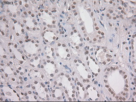 NOTCH1 Antibody - IHC of paraffin-embedded Kidney tissue using anti-NOTCH1 mouse monoclonal antibody. (Dilution 1:50).