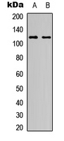 NOTCH1 Antibody - Western blot analysis of NOTCH1 expression in HeLa (A); NIH3T3 (B) whole cell lysates.