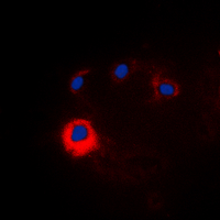 NOTCH1 Antibody - Immunofluorescent analysis of NOTCH1 staining in HeLa cells. Formalin-fixed cells were permeabilized with 0.1% Triton X-100 in TBS for 5-10 minutes and blocked with 3% BSA-PBS for 30 minutes at room temperature. Cells were probed with the primary antibody in 3% BSA-PBS and incubated overnight at 4 deg C in a humidified chamber. Cells were washed with PBST and incubated with a DyLight 594-conjugated secondary antibody (red) in PBS at room temperature in the dark. DAPI was used to stain the cell nuclei (blue).
