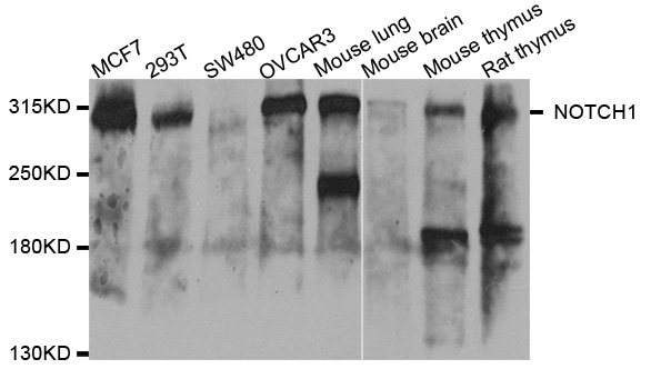 NOTCH1 Antibody - Western blot analysis of extracts of various cell lines.