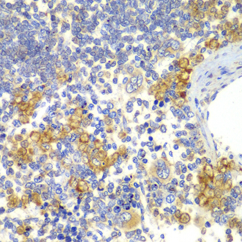 NOTCH1 Antibody - Immunohistochemistry of paraffin-embedded rat spleen tissue.