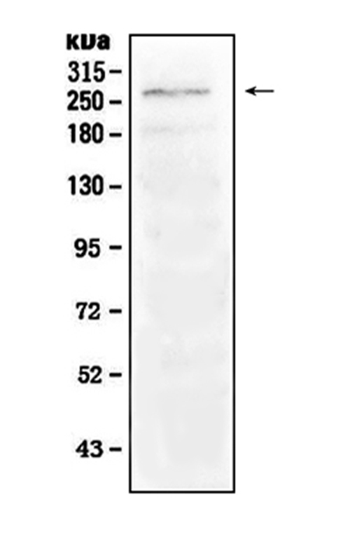 NOTCH1 Antibody - Western blot analysis of Notch1 using anti-Notch1 antibody. Electrophoresis was performed on a 5-20% SDS-PAGE gel at 70V (Stacking gel) / 90V (Resolving gel) for 2-3 hours. The sample well of each lane was loaded with 50ug of sample under reducing conditions. Lane 1: mouse skeletal muscle tissue lysate. After Electrophoresis, proteins were transferred to a Nitrocellulose membrane at 150mA for 50-90 minutes. Blocked the membrane with 5% Non-fat Milk/ TBS for 1.5 hour at RT. The membrane was incubated with rabbit anti-Notch1 antigen affinity purified polyclonal antibody at 0.5 µg/mL overnight at 4°C, then washed with TBS-0.1% Tween 3 times with 5 minutes each and probed with a goat anti-rabbit IgG-HRP secondary antibody at a dilution of 1:10000 for 1.5 hour at RT. The signal is developed using an Enhanced Chemiluminescent detection (ECL) kit with Tanon 5200 system. A specific band was detected for Notch1 at approximately 272KD. The expected band size for Notch1 is at 272KD.