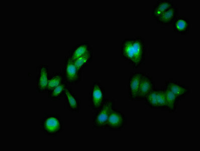 NOTCH1 Antibody - Immunofluorescent analysis of HepG2 cells at a dilution of 1:100 and Alexa Fluor 488-congugated AffiniPure Goat Anti-Rabbit IgG(H+L)