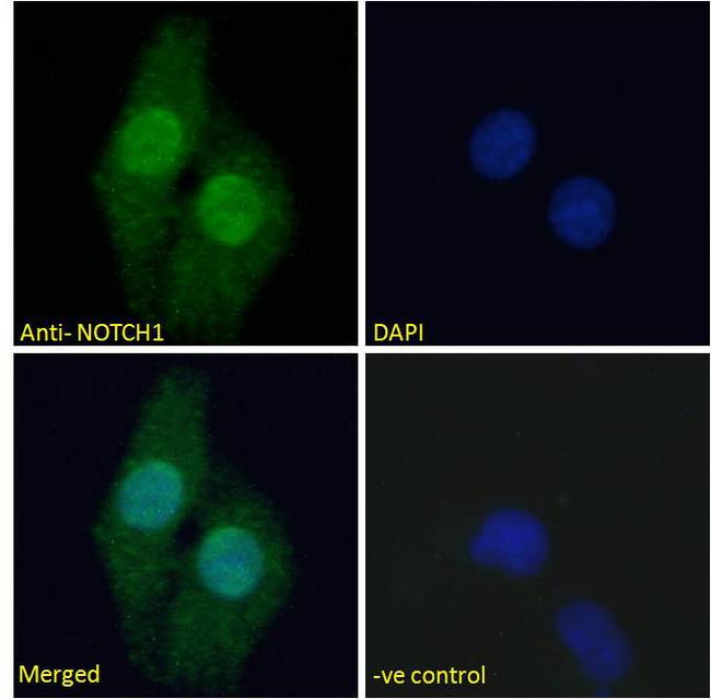 NOTCH1 Antibody - Immunofluorescence analysis of paraformaldehyde fixed U2OS cells, permeabilized with 0.15% Triton. Primary incubation 1hr (5ug/ml) followed by Alexa Fluor 488 secondary antibody (2ug/ml), showing nuclear staining. The nuclear stain is DAPI (blue). Negative control: Unimmunized goat IgG (5ug/ml) followed by Alexa Fluor 488 secondary antibody (2ug/ml).