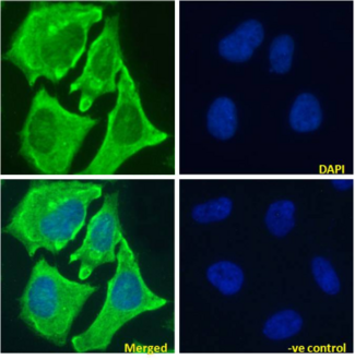 NOTCH1 Antibody - IF staining of HeLa cells.