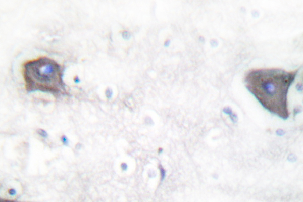 NOTCH1 Antibody - IHC of Cleaved-Notch 1 (V1754) pAb in paraffin-embedded human brain tissue.