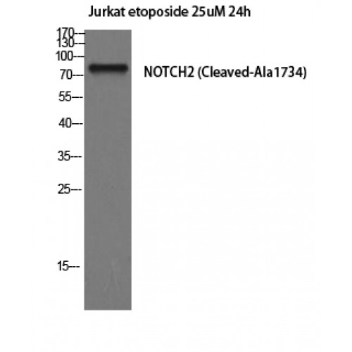 NOTCH2 Antibody - Western blot of Cleaved-Notch 2 (A1734) antibody