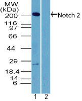 NOTCH2 Antibody - Western blot of NOTCH2 in human brain lysate in the 1) absence and 2) presence of immunizing peptide using Polyclonal Antibody to NOTCH2 at 2 ug/ml. Goat anti-rabbit Ig HRP secondary antibody, and PicoTect ECL substrate solution were used for this test.